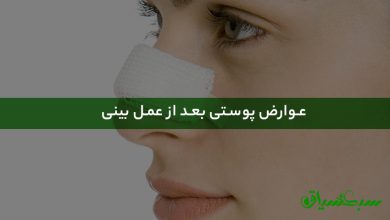 عوارض پوستی بعد از عمل بینی